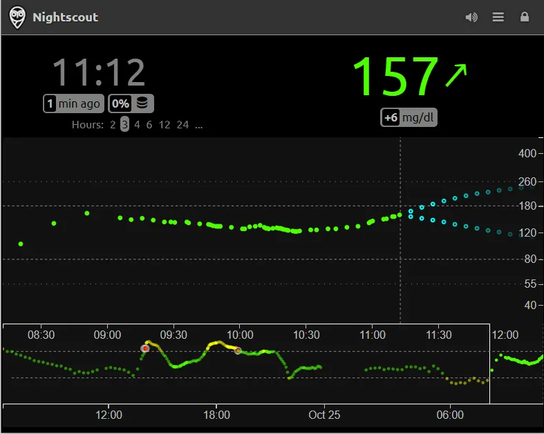 Main view with the current glucose of 157 mg/dl and a rising arrow, a 3-hour chart with predicted readings, and a 48-hour overview below